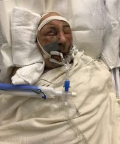 (4 Pack) Globe Bacitracin Zinc Ointment + Aloe 1oz, Antibiotic Ointment, Essential Antibiotic First Aid Supplies, Healing Action, Maximum Antibiotic Power, Prevents Infection in cuts, scrapes, Burns 30 71nRmFCit3L