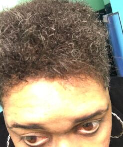 Intensive Biotin Hair Growth Serum - Spray - Hair Loss, Receding Hairline & Pattern Baldness Treatment For Women & Men With Thinning Hair - Dht Blocker - Sulfate-Free by Amplixin (2oz) Biotin Serum 42 71nfz6OKM2L 1