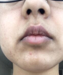 Eve Hansen Vitamin C Serum for Face | (2 OZ) Facial Serum with Natural, Organic Hyaluronic Acid, Vitamin E and Aloe Vera | Brighten, Reduce Appearance of Wrinkles, Fine Lines and Dark Spots 2 Fl Oz (Pack of 1) 32 71nfzLuop2L