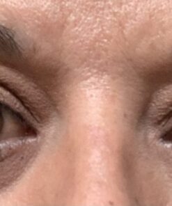 LUMIFY Redness Reliever Eye Drops 0.17 Fl Oz (5 mL) 35 71nmAE2G3dL