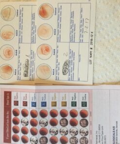 Eldoncard Blood Typing Kit, 3 Tests, Know Your Blood Type, Instant Home Testing Kit, A, O, B, Rhs-D Negative and Positive Blood Types Tested For 29 71ntKegPqeL