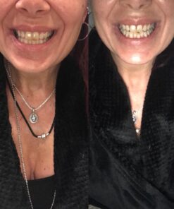 Active Wow Activated Coconut Charcoal Powder - Natural Whitening Activated Charcoal, Charcoal Vanilla Toothpaste, Fluoride Free, Sulfate & Paraben Free, Charcoal Toothpaste Powder (All Natural) All Natural 56 71nufAPwDCL