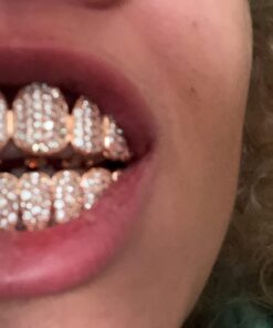 TSANLY Gold Grillz Iced Out CZ Diamond Top & Bottom Set Grill 24K Gold Plated Macro Pave Teeth Grills - Extra Molding Bars Included + Storage Case + Microfiber Cloth Rose Gold 17 71o2XlDQuiL