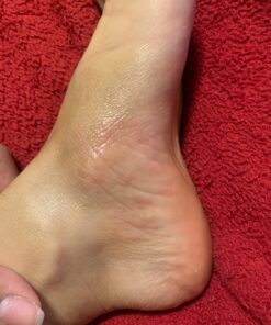 MG217 Multi Symptom Relief 2% Coal Tar Medicated Psoriasis Ointment oz Jar, 4 Oz 4 Ounce (Pack of 1) 49 71o6 dZfZHL