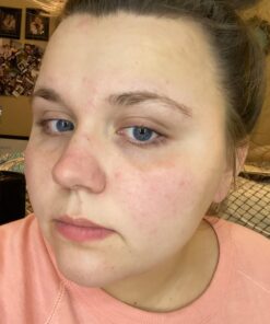 TruSkin Vitamin C Face Serum – Anti Aging Face & Eye Serum with Vitamin C, Hyaluronic Acid, Vitamin E – Brightening Serum, Dark Spot Remover, Even Skin Tone, Eye Area, Fine Lines & Wrinkles, 1 Fl Oz 1 Fl Oz (Pack of 1) 52 71oDiRUvhrL