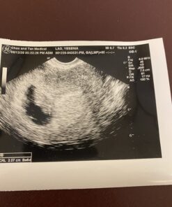 Conceive Plus Fertility Supplements for Men, Male Fertility Booster Prenatal – Optimal Sperm Count & Motility - Maca, L-Arginine, Zinc, Folate Folic Acid & Magnesium – 60 Vegetarian Soft Blue Capsules 36 71oEM0MQ6L 2