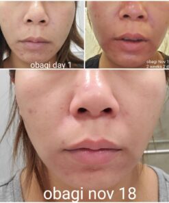 Obagi Medical CLENZIderm M.D. System Pack of 1 27 71oYTVPQKL