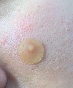 Nexcare Acne Cover, Skin Cover Absorbs Pus and Oil From Clogged Pores, Suitable Skincare for Most Skin Types - 36 Acne Covers 36 Count (Pack of 1) 50 71ogsL3pxEL