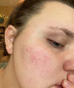 TruSkin Vitamin C Face Serum – Anti Aging Face & Eye Serum with Vitamin C, Hyaluronic Acid, Vitamin E – Brightening Serum, Dark Spot Remover, Even Skin Tone, Eye Area, Fine Lines & Wrinkles, 1 Fl Oz 1 Fl Oz (Pack of 1) 53 71owGa00kHL