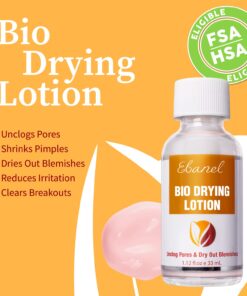 Ebanel Acne Drying Lotion, Overnight Salicylic Acid and Sulfur Cystic Acne Spot Treatment for Face and Body, Pimple Cream Spot Treatment, Dries Out Pimples, Cysts, Blemishes, Zits, and Clogged Pores 23 71ozxBYPrEL