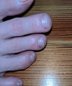 DAILY REMEDY Tea Tree Oil Extra Strength Super Balm - Athletes Foot Cream Combats Ringworm, Jock Itch, Nail Issues - Nourishes Cracked Itchy Skin on Body & Feet - Made in USA 2 Ounce (Pack of 1) 32 71pDikkrRRL