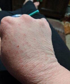 O'Keeffe's Working Hands Hand Cream, Relieves and Repairs Extremely Dry Hands, 3 oz Tube, (Pack of 2) 3 Ounce (Pack of 2) 43 71pPkPTYsHL