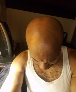 Pronexa Topical Hair Loss Serum by Hairgenics Stops Hair Loss and Accelerates Hair Growth and Hair Regrowth in Balding and Thinning Areas. 1 FL OZ. 27 71pep4SLLiL