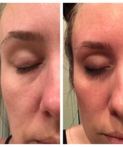 TruSkin Vitamin C Face Serum – Anti Aging Face & Eye Serum with Vitamin C, Hyaluronic Acid, Vitamin E – Brightening Serum, Dark Spot Remover, Even Skin Tone, Eye Area, Fine Lines & Wrinkles, 1 Fl Oz 1 Fl Oz (Pack of 1) 48 71qVFZ1NyLL