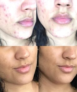 NOW Foods Supplements,Pantothenic Acid (Vitamin B-5) 500 mg,B-Complex Vitamin,250 Capsules 250 Count (Pack of 1) 35 71rIqbY43ZL