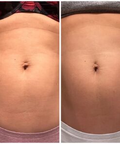 Nivea Skin Firming and Toning Body Gel Cream with Q10, Firming Body Cream, Moisturizing Skin Cream, 6.7 Oz Tube Skin Firming Gel 48 71rZbrWjnpL