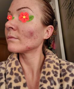 Sports Research Vitamin D3 5000 IU with Coconut MCT Oil - High Potency Vitamin D Supplement for Immune & Bone Support - Non-GMO Verified, Gluten & Soy Free – 125mcg, 360 Liquid Softgels 360 Count (Pack of 1) 39 71rl5OCqlDL