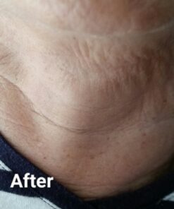 Silc Skin Collette Pad to Help with Neck & Collarbone Wrinkles from Sun, Aging, Side Sleeping, Reusable Self Adhesive Medical Grade Silicone, 1 Pad 13 71roDCXDToL