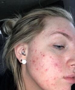 Alani Nu Balance | Supplement for Women | Hormonal Support | Weight Management and Clear Complexion | Gluten Free | Vegan | Sugar Free | 120 Veggie Capsules | 30 Day Supply Unflavored 39 71s7RsrIElL