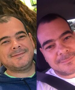 Growth Treatment Unscented 5% (Foam) 2 Ounce (Pack of 1) 19 71sN4smh2rL