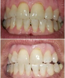 Crest 3D White Toothpaste Radiant Mint, 3.8 Oz (Pack of 3) 3.8 Ounce (Pack of 3) 39 71sT6xUaZdL