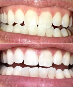 Large 12 Oz. Coconut Activated Charcoal Powder. Whitens Teeth, Rejuvenates Skin and Hair, Supports Better Digestion. USA-Owned Producers, Free Scoop 12 Ounce (Pack of 1) 27 71snkAzRIXL