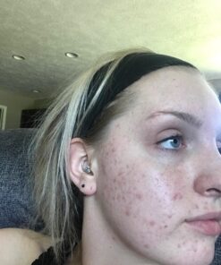 Alani Nu Balance | Supplement for Women | Hormonal Support | Weight Management and Clear Complexion | Gluten Free | Vegan | Sugar Free | 120 Veggie Capsules | 30 Day Supply Unflavored 38 71stA9e3LL