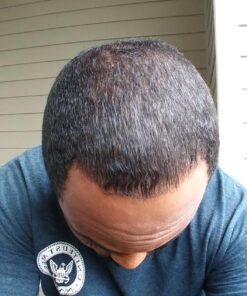 VH Nutrition FOLLIFORM | DHT Blocker for Men and Women* | Saw Palmetto, Pygeum, Nettle Root Formula | 1500mg | 60 Capsules 28 71su1zaCW3L