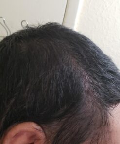 artnaturals Argan Hair Growth Shampoo - (16 Fl Oz / 473ml) - Sulfate Free - Treatment for Hair Loss, Thinning & Regrowth - Men & Women - Infused with Biotin, Argan Oil, Keratin, Caffeine 41 71tQ7GOCbpL