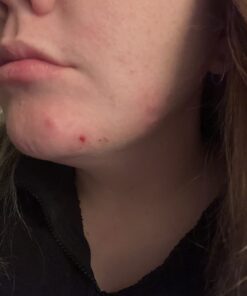 Terrasil Wound Care - 3X Faster Healing, Infection Protection Ointment for bed sores, pressure sores, diabetic wounds, ulcers, cuts, scrapes, and burns (14 gram tube) 48 71tiMejWPFL