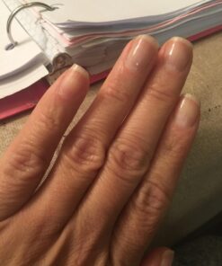 PUR360 Tamanu Oil - Best Treatment for Psoriasis, Eczema, Acne Scar, Rosacea - Relief for Dry, Scaly Skin, Scalp and More - Cold Pressed – Proven 100% Pure 42 71tmrPocHsL