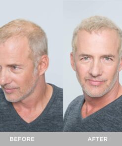 XFusion Keratin Hair Fibers - Black (Large Size 28g) Medium Brown 23 71uX2qP8OqL