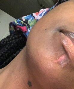 Active Skin Repair First Aid Scar Shield Hydrogel - Scar Treatment for Cuts, Scrapes, Burns and Other Wounds to Stop Scars BEFORE They Form - Natural and Non-Toxic Scar Prevention Gel (3 oz Gel) 28 71uaDIpgMuL