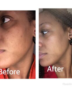 TOULON Aloe Vera Face Wash - Anti Aging Face Cleanser for Oily Skin & Acne-Free Clear Complexion. Antioxidant Facial Cleanser For Women and Men 14 71uiNiXmMYL