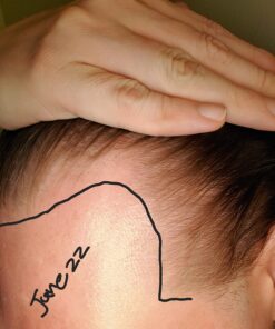 DHT BLOCKER - Hair Growth Supplement for Genetic Thinning for Men and Women | Approved* by American Hair Loss Association | Guaranteed, Backed by 20 Years of Experience in Hair Loss Treatment Clinics 60 71vBkMtm9gL