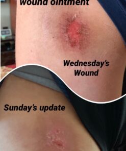 Terrasil Wound Care - 3X Faster Healing, Infection Protection Ointment for bed sores, pressure sores, diabetic wounds, ulcers, cuts, scrapes, and burns (14 gram tube) 35 71vG mlRWuL