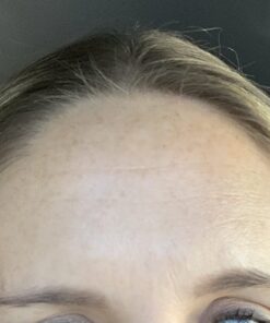 Frownies Forehead and Between Eyes Wrinkle Patches The Original Wrinkle Patch Non Invasive Wrinkle Smoothers for Forehead Wrinkles 36 71vLYjqx04L