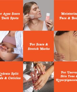 Bio-Oil Skincare Body Oil, Vitamin E Serum for Scars & Stretchmarks, Dermatologist Recommended, All Skin Types, 6.7 oz 6.7 Fl Oz (Pack of 1) 26 71vPpnls39L 1