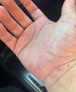 DAILY REMEDY Tea Tree Oil Extra Strength Super Balm - Athletes Foot Cream Combats Ringworm, Jock Itch, Nail Issues - Nourishes Cracked Itchy Skin on Body & Feet - Made in USA 2 Ounce (Pack of 1) 29 71vXMjIiieL 3