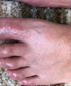 Tea Tree Oil Balm , Extra Strength, Pair Well with Jock Itch Cream, Spray, Athletes Foot, Ringworm Cream for Human, Fast Acting for Dry, Itchy Skin, Plant Powered Wonder Balm 45 71vfMyaoCOL