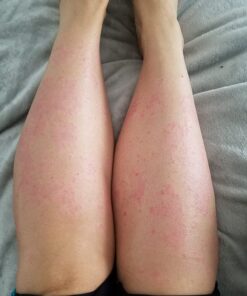 Black Seed Oil - 120 Softgel Capsules Skin Health (Non-GMO & Vegan) Cold-Pressed Nigella Sativa Producing Pure Black Cumin Seed Oil with Vitamin E - 500mg Each, 1000mg Per 2 Capsule Serving Capsules (120 Count) 31 71vrAXEpvoL 1