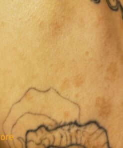 MG217 Multi Symptom Relief 2% Coal Tar Medicated Psoriasis Ointment oz Jar, 4 Oz 4 Ounce (Pack of 1) 45 71wroYBtEwL