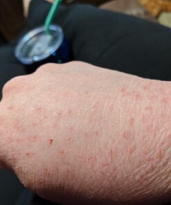 O'Keeffe's Working Hands Hand Cream, Relieves and Repairs Extremely Dry Hands, 3 oz Tube, (Pack of 2) 3 Ounce (Pack of 2) 44 71xXBUZ74QL