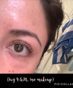 Moisturising Cream, Body and Face Moisturizer for Dry Skin, Acne Cream, 2PC 0.53 Ounce (Pack of 1) 45 71yRmlpMpCL