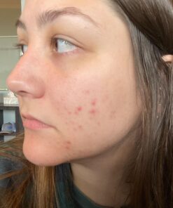 Alani Nu Balance | Supplement for Women | Hormonal Support | Weight Management and Clear Complexion | Gluten Free | Vegan | Sugar Free | 120 Veggie Capsules | 30 Day Supply Unflavored 43 71z0iDw5RL