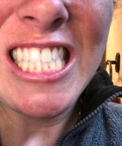 Opalescence 35% Gel Syringes Teeth Whitening - Refill Kit (2 Packs / 4 Count) Carbamide Peroxide. Made by Ultradent, in Cool Mint Flavor. Tooth Whitening Refill Syringes 5197-2 Mint 35 4 Count (Pack of 1) 36 71z101ltz0L