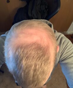 iRestore Essential Laser Hair Growth System - FDA Cleared Hair Loss Treatments for Men & Women & Hair Growth Products for Men with Thinning Hair, Hair Regrowth Treatments Laser Cap, Red Light Therapy 39 71zA3zm5mzL