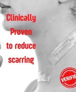 SilverSeal Burn and Wound Dressing | Hydrogel Pads with X-Static Silver | Soothing, Moist & Protective | Burns, Cuts & Wounds | 4 Sterile Dressings 4"x4" Patch (4 Count) 42 71zxGdOv 6L