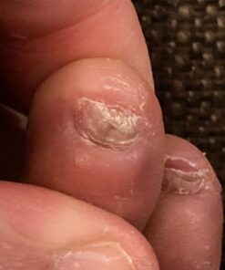 PURELY NORTHWEST-Tea Tree Oil & Peppermint Foot Soak with Epsom Salt-for Stubborn Foot Odor, Athletes Foot Burning & Itching, Damaged Discolored Nails-A Natural Callus Remover 16 Ounces 1 Pound (Pack of 1) 45 81 kyCBaoiL