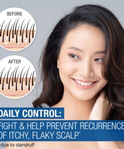 Neutrogena Scalp Therapy Anti-Dandruff Shampoo Daily Control, 1.8% salicylic acid, with fragrance of warm vanilla & toasted coconut notes, 12 fl oz 27 81 m1jg9WIL